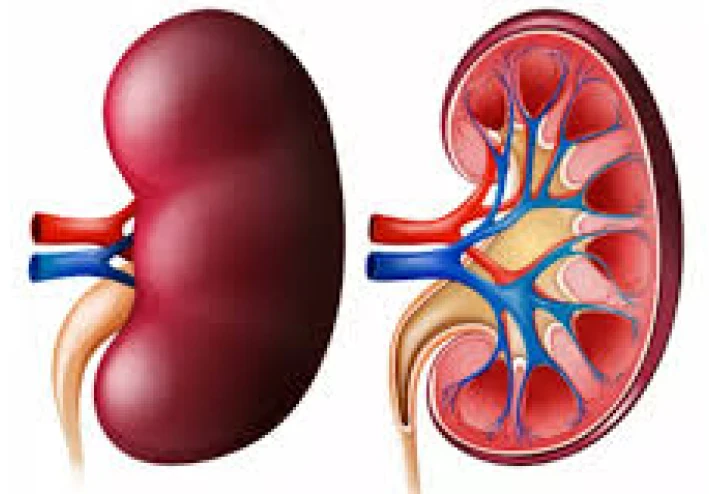 اعتلال الكلية السكري: الأسباب، والأعراض، والعلاج