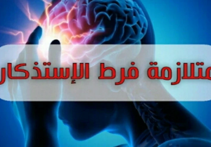 عندما يصبح تذكر كل شئ عبئا