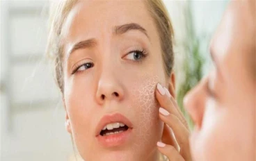 المرض الذى حير الاطباء