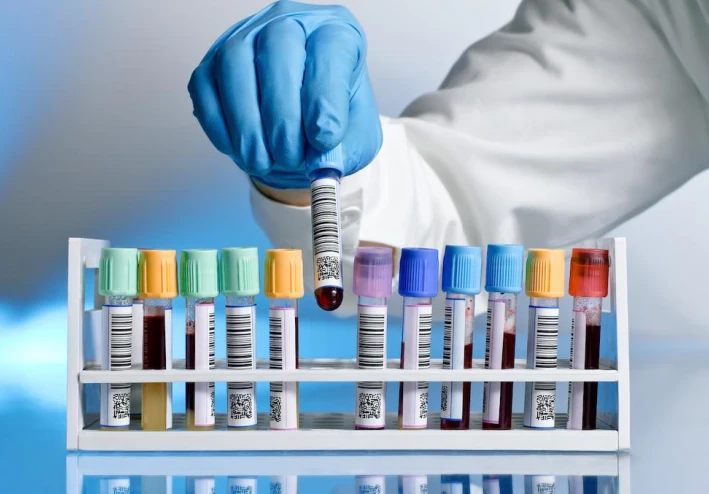 هل معامل الروماتويد يدل على وجود روماتويد مفصلي ؟