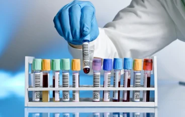 هل معامل الروماتويد يدل على وجود روماتويد مفصلي ؟