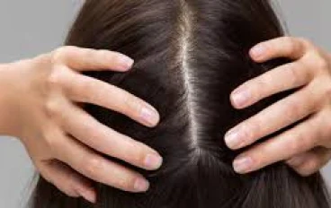 للبنات المقدمة على الزواج   اسرار أمراض فروة الرأس الشائعة وأحدث العلاجات: دليل ثقافى طبي 