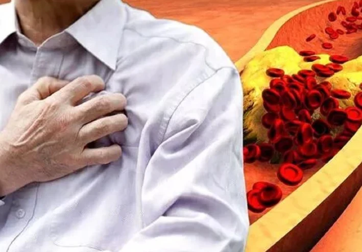 الكوليسترول الضار الموروث: 5 علامات تحذيرية يجب ألا تتجاهلها