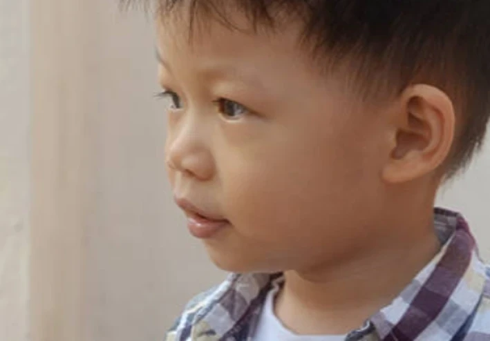 طفل بريطاني ابتلع مغناطيسًا لتحدي “تيك توك” انظر ماذا حدث في أمعائه