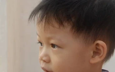 طفل بريطاني ابتلع مغناطيسًا لتحدي “تيك توك” انظر ماذا حدث في أمعائه