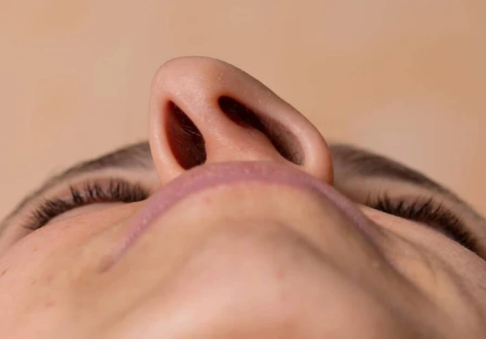 انحراف الحاجز الأنفي