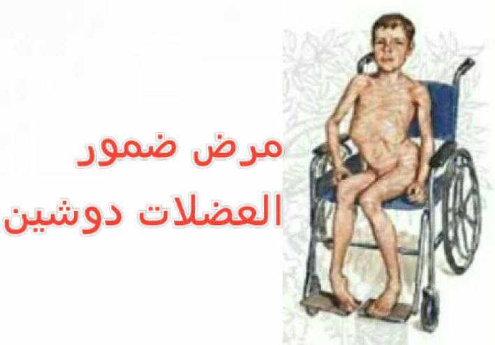 التحدي الجيني الذي يواجهه العضلات