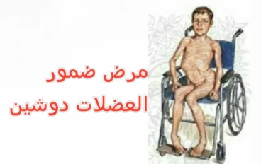 التحدي الجيني الذي يواجهه العضلات