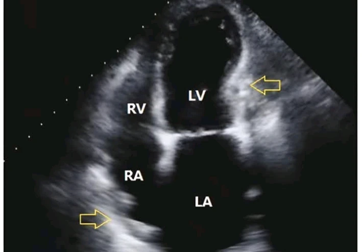 من يوميات طبيب قلب