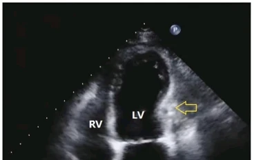 من يوميات طبيب قلب