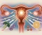 صورة مقال The 90-Day Ovarian Reboot: A Mitochondrial Protocol to Reignite Ovulation and Nurture Egg Quality