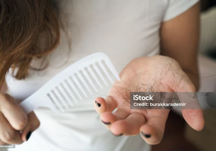 مشروبات شتوية شهيرة تسبّب تساقط الشعر: احذر هذه العادات اليومية التي تضعف جذور شعرك