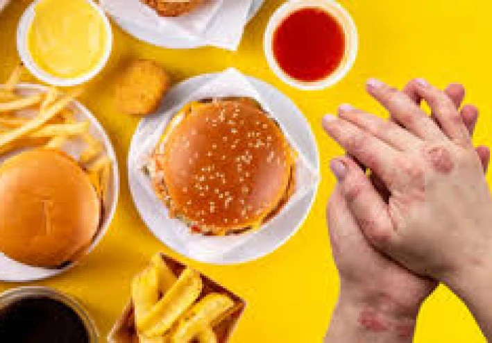 إنهم يسعدون ، ويأكلون المزيد والمزيد ، لكنهم يسلبون صحتنا: معضلة الأطعمة فائقة المعالجة