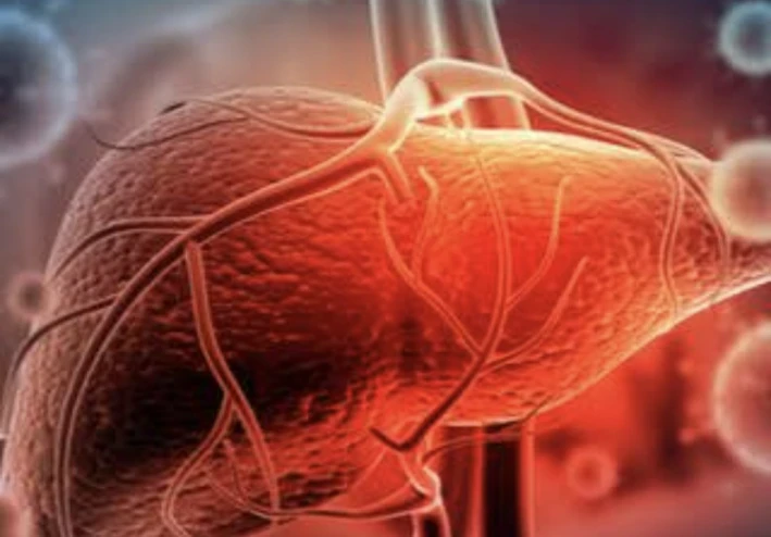 تلف الكبد يبدأ من البول: 5 علامات تحذيرية لا يجب تجاهلها