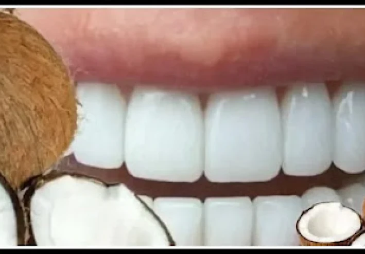 3 أسباب وجيهة لتنظيف أسنانك بزيت جوز الهند