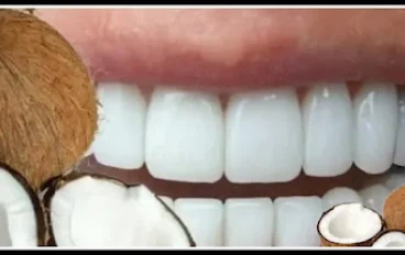 3 أسباب وجيهة لتنظيف أسنانك بزيت جوز الهند