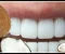 صورة مقال 3 أسباب وجيهة لتنظيف أسنانك بزيت جوز الهند