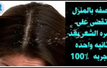 خل التفاح ضد القشرة، لذا افعلوا ذلك