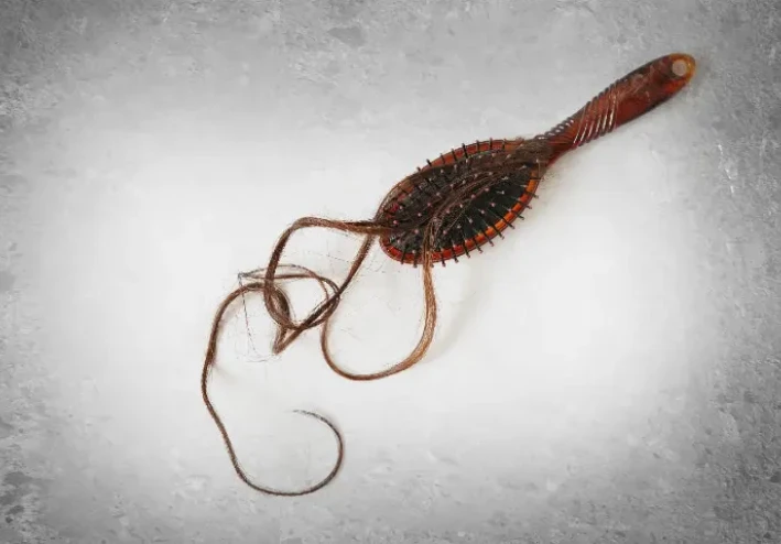 تساقط الشعر بسبب العلاج الكيميائي