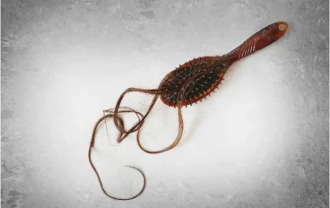 تساقط الشعر بسبب العلاج الكيميائي