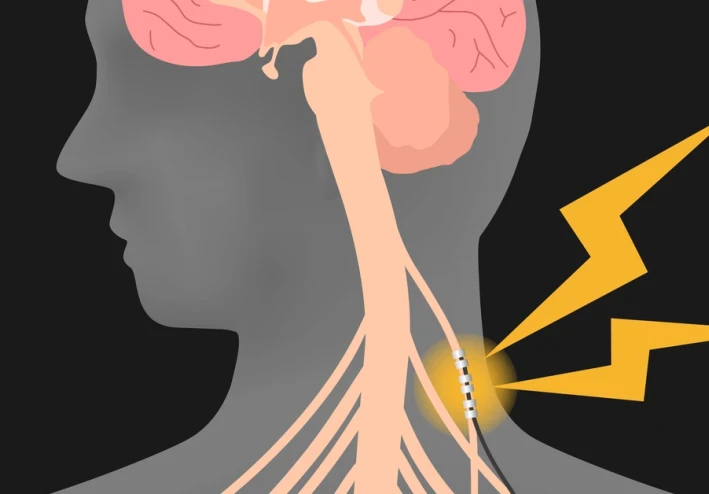 عدم التحكم في أعصابك وحالتك العاطفية يمكن أن يجعلك تكتسب وزنا وتشعر بالانتفاخ (والعكس صحيح)