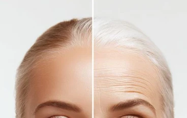 ✨ عادات يومية بتسرّع ظهور التجاعيد من غير ما تاخدي بالك