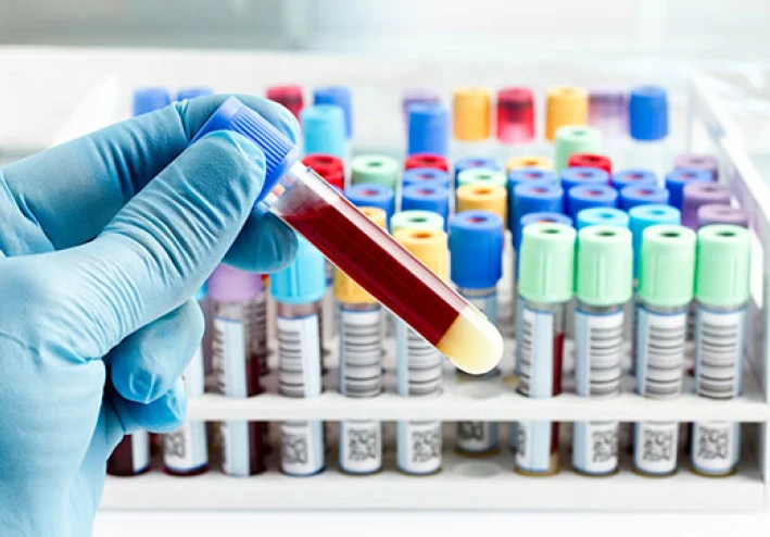 المختبرات الطبية -وأهميتها في تشخيص الامراض