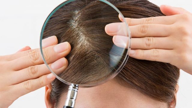 صورة مقال وداعاً للقشرة والزيوت المزعجة: الدليل النهائي لتنظيف الفروة الدهنية وإعادة حيوية شعرك جوجل