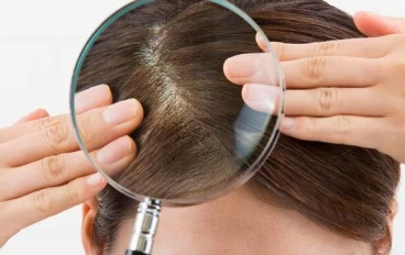 وداعاً للقشرة والزيوت المزعجة: الدليل النهائي لتنظيف الفروة الدهنية وإعادة حيوية شعرك جوجل