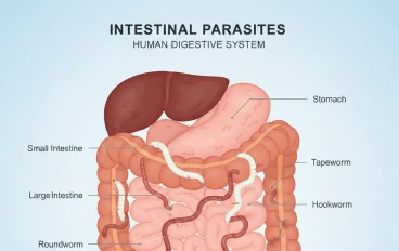 الديدان التي تصيب الإنسان: الأسباب والأعراض وطرق الوقاية والعلاج الطبيعي