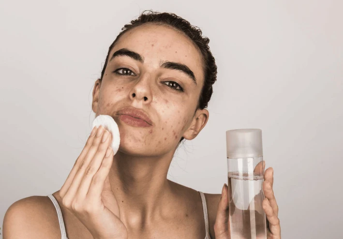 التخلص من البشرة الدهنية نهائياً بوصفة سحرية وبدون أضرار الكريمات