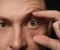 صورة مقال الصفراء ( Jaundice): أسبابها وطرق علاجها الصحيحة