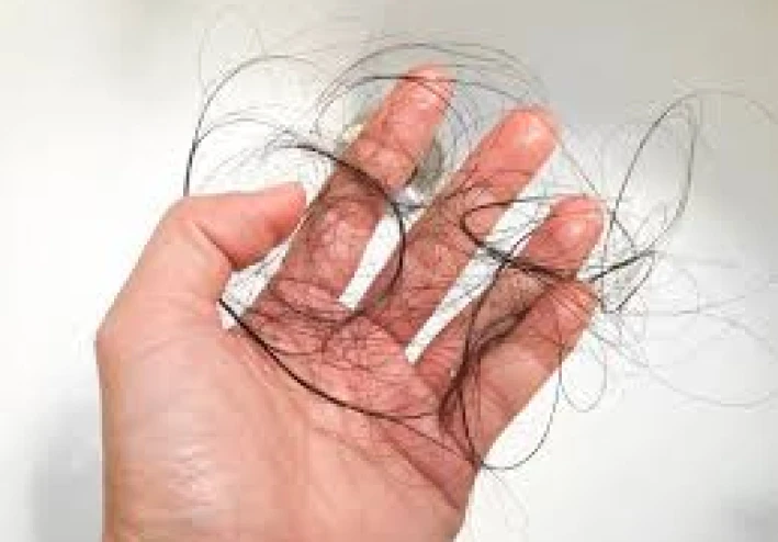 يذهب الإجهاد المزمن إلى الرأس: هذه هي الطريقة التي يبتلع بها الكورتيزول صحة فروة الرأس ويضعف الشعر