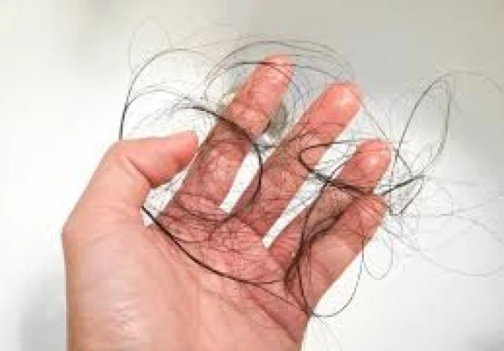 يذهب الإجهاد المزمن إلى الرأس: هذه هي الطريقة التي يبتلع بها الكورتيزول صحة فروة الرأس ويضعف الشعر