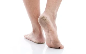 كيف تعتني بقدميك إذا كنت ستقف على قدميك لفترة طويلة