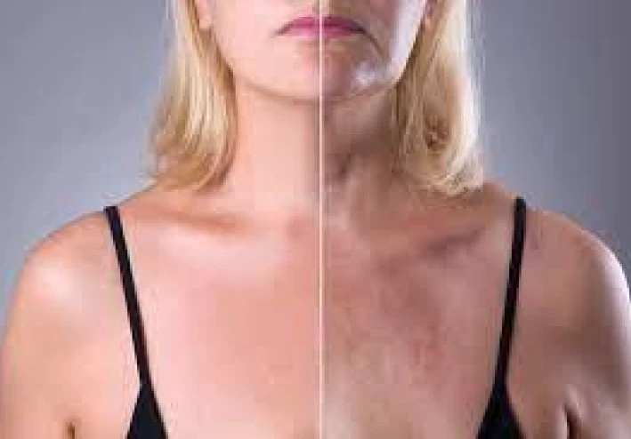 إذا كانت حمالة الصدر النائمة فعالة ضد تجاعيد الصدر وخط العنق