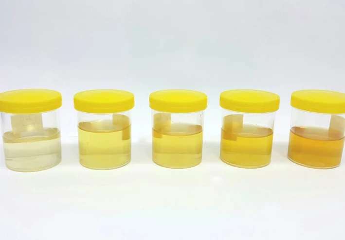 "لون البول يساعدك على معرفة ما إذا كان هناك خطأ ما في جسمك"