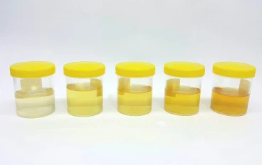  "لون البول يساعدك على معرفة ما إذا كان هناك خطأ ما في جسمك"