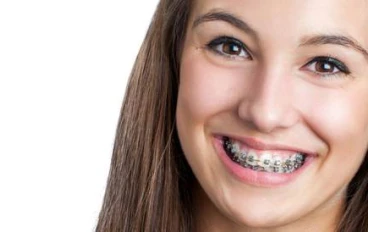 صعود تقويم الأسنان في 50: يبدو وكأنه تافه ولكنه يمنع المشاكل الصحية