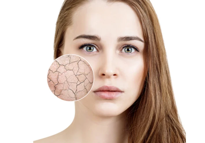 "لن يتم حل البشرة الجافة بغض النظر عن عدد الكريمات التي تضعها إذا واصلت فعل ذلك"