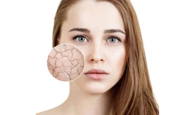  "لن يتم حل البشرة الجافة بغض النظر عن عدد الكريمات التي تضعها إذا واصلت فعل ذلك"