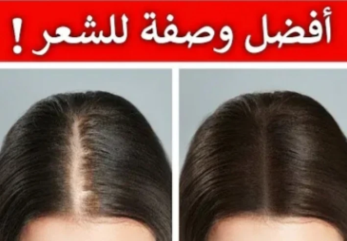 اثنا عشر علاج منزليا بسيطا لتساقط الشعر ولتقوية نمو الشعر ايضا