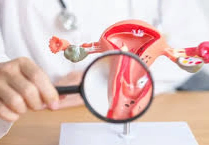 أدوية السمنة تقدم حلا لليأس من مرضى بطانة الرحم