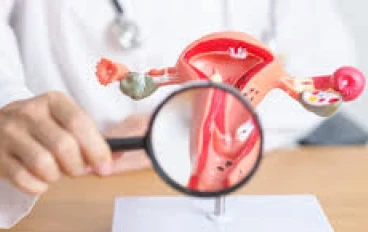 أدوية السمنة تقدم حلا لليأس من مرضى بطانة الرحم