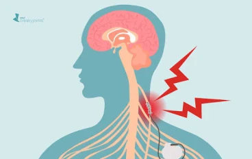 كيف تقى نفسك من التهاب العصب الحائر 