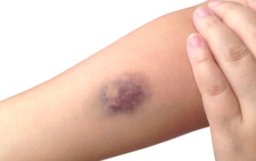 نحتاج إلى مزيد من التلامس مع الجلد: الحزن المتراكم والإجهاد الزائد يمكن أن يجعلك تبكي أثناء التدليك اليدوي البسيط