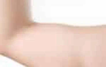 لماذا الدهون الذراع سيئة لصحتك... والذاكرة الخاصة بك