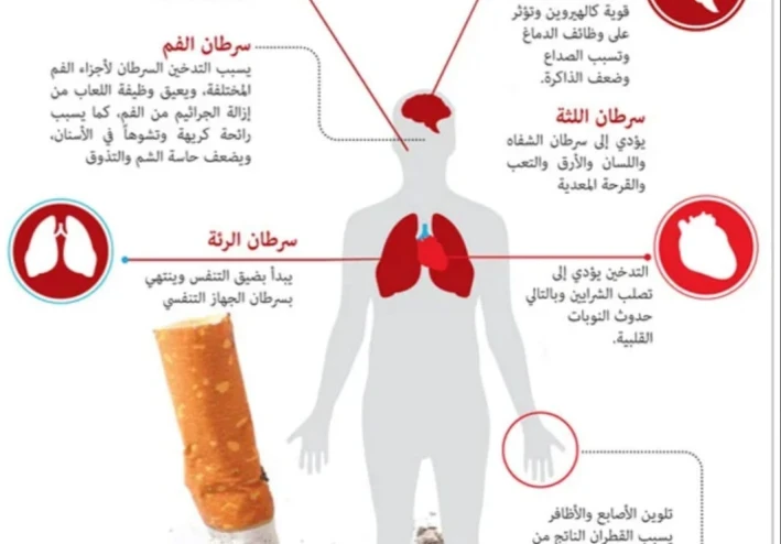 أضرار التدخين على الصحة وكيفية الإقلاع نهائياً