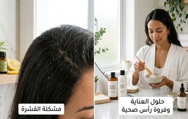 العنايه بالشعر وحل نهائي لازاله القشره لمنع التساقط