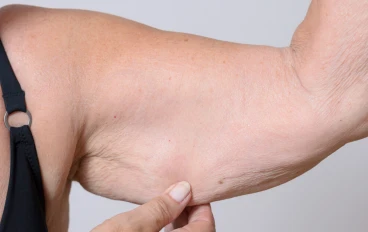   الترهل في سن اليأس  هذا العلاج هو القنبلة"